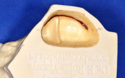 schneider-membrane-1-1-1 (1)