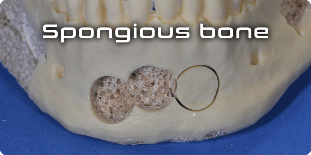 Spongious bone