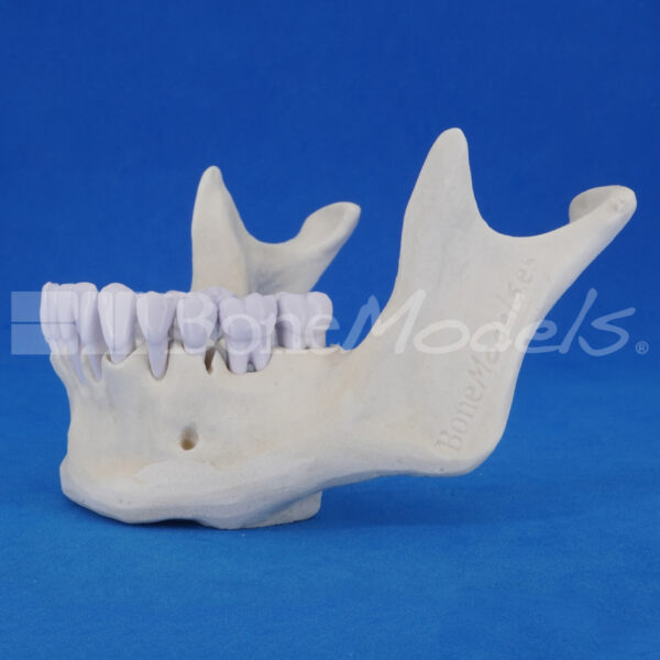 Mandibula-perio-10
