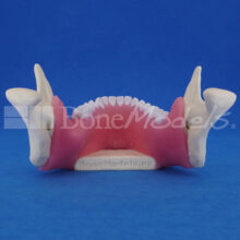 Mandibula-perio-5