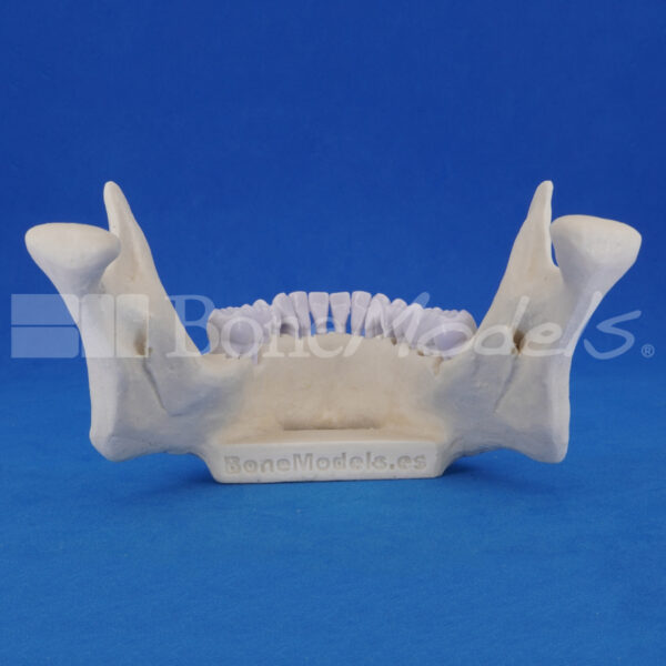 Mandibula-perio-9